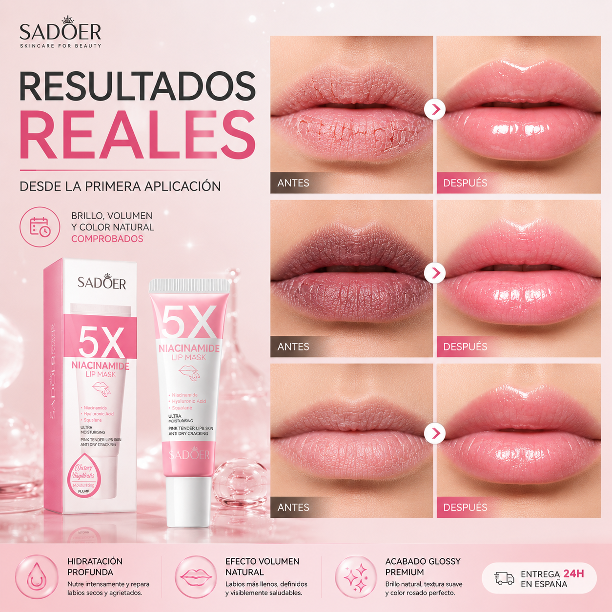 SADOER 5X Mascarilla Labial con Niacinamida – Efecto Labios Carnosos, Rosados e Hidratados 10g